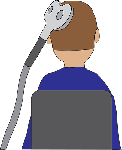Drawing of a TMS coil being placed on a participant's head.